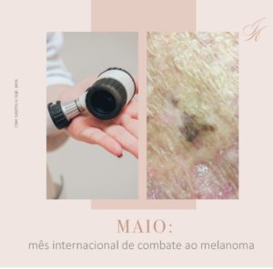 Leia mais sobre o artigo Mês internacional de combate ao melanoma!