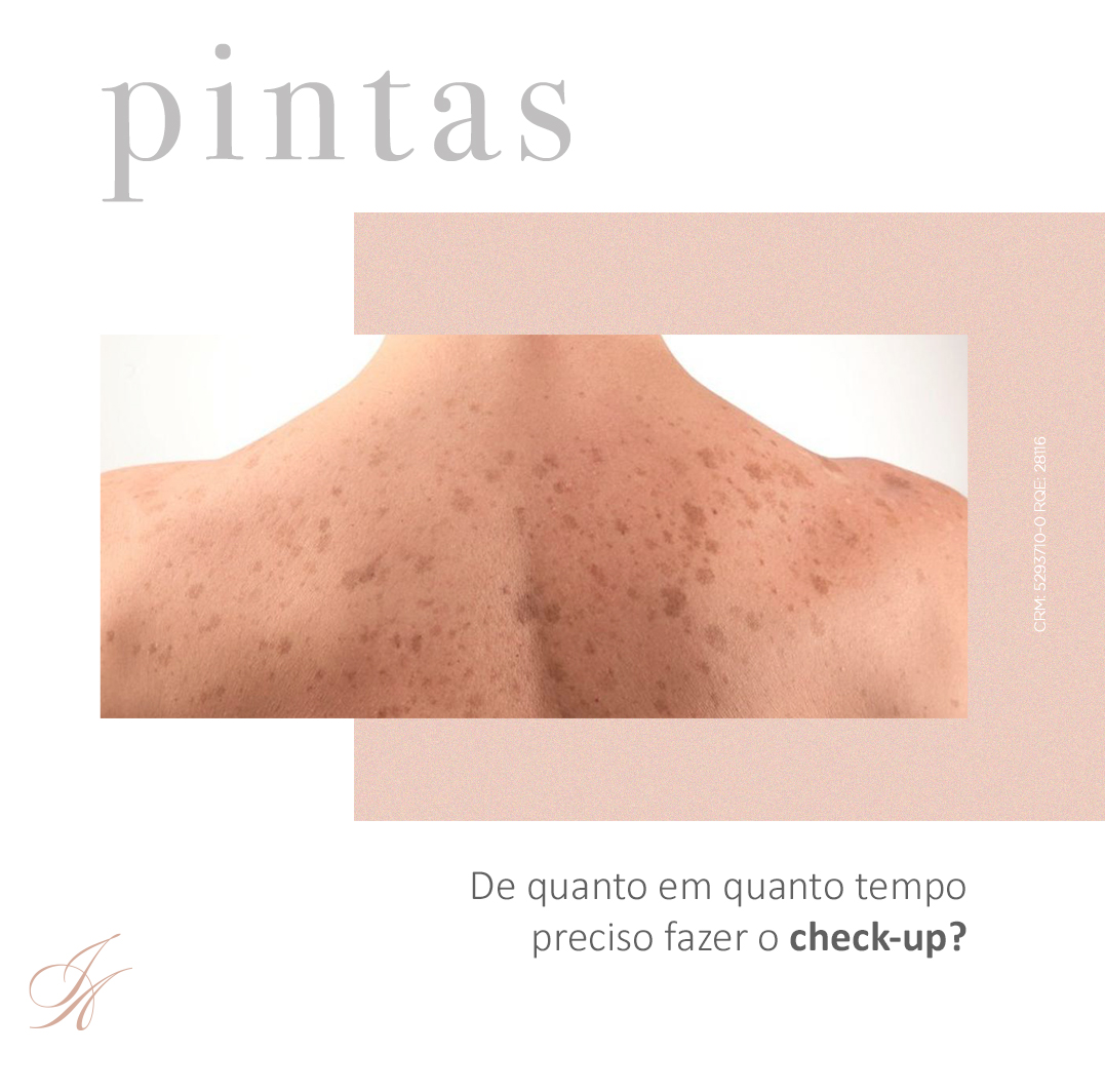 Você está visualizando atualmente Pintas! De quanto em quanto tempo preciso fazer o check-up?