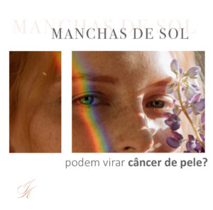 Leia mais sobre o artigo Manchas de sol podem virar câncer de pele?