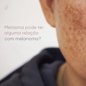 Leia mais sobre o artigo Melasma pode ter alguma relação com melanoma?