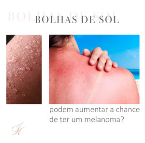 Leia mais sobre o artigo Bolhas de sol podem aumentar a chance de ter um melanoma?