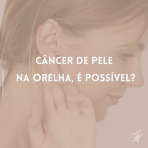 Leia mais sobre o artigo Câncer de pele na orelha, é possível?