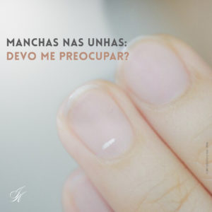 Leia mais sobre o artigo Manchas nas unhas: devo me preocupar?