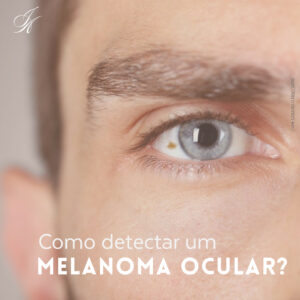 Leia mais sobre o artigo Como detectar um melanoma ocular?