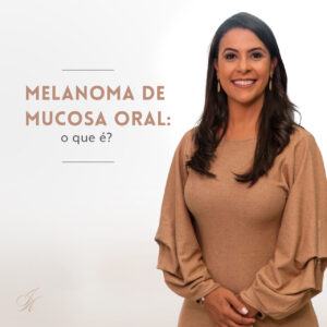 Leia mais sobre o artigo Melanoma de mucosa oral: o que é?