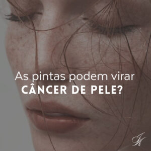 Leia mais sobre o artigo As pintas podem virar câncer de pele?