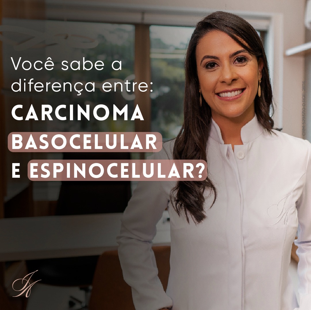 Você está visualizando atualmente Diferença entre Carcinoma Basocelular e Espinocelular: