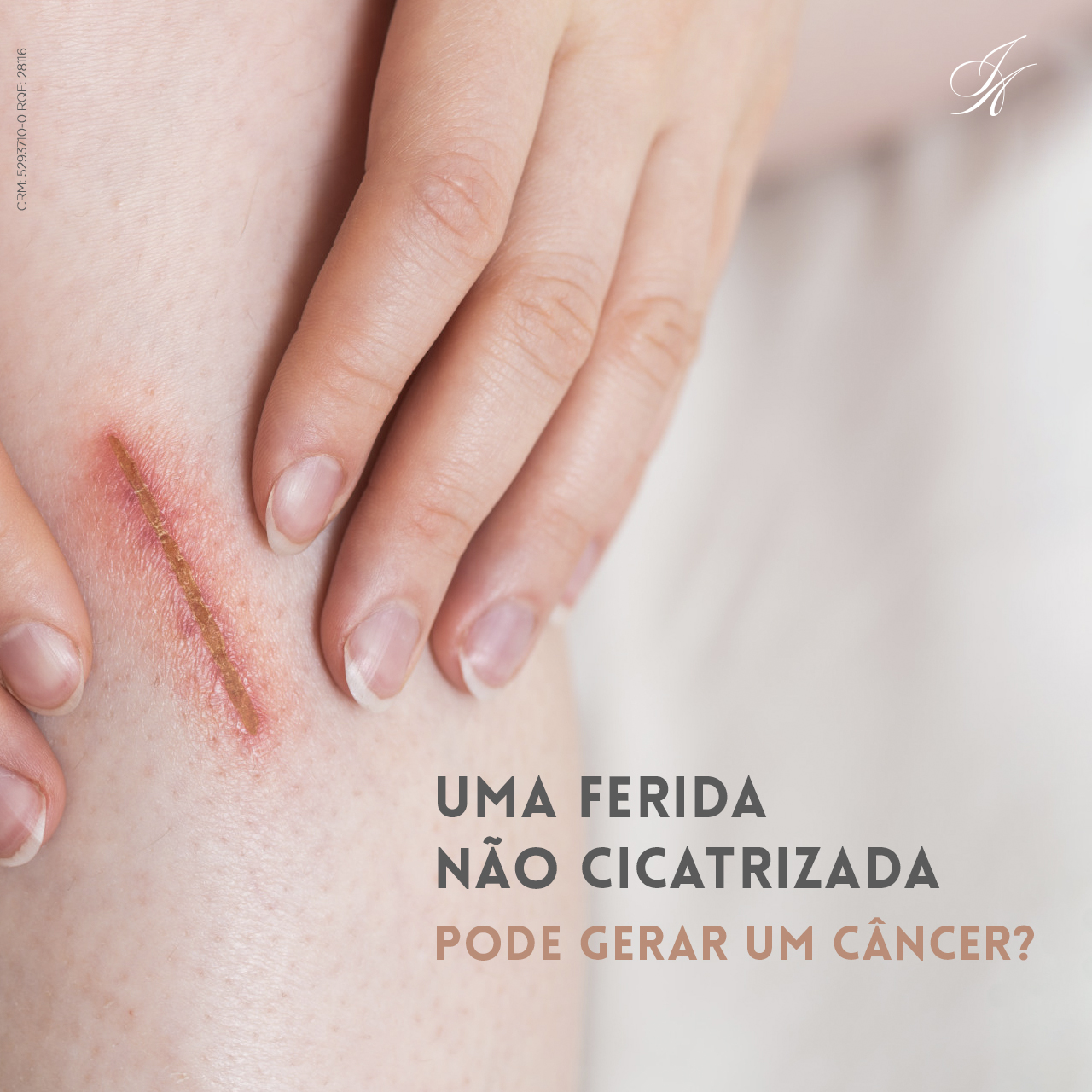 Você está visualizando atualmente Uma ferida não cicatrizada pode ser um câncer?