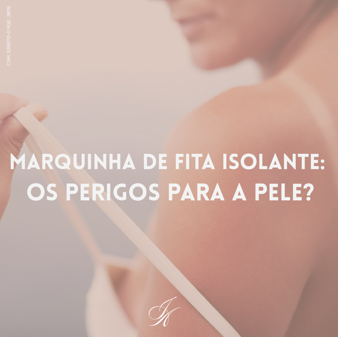 Você está visualizando atualmente Marquinha de fita isolante: os perigos para a pele