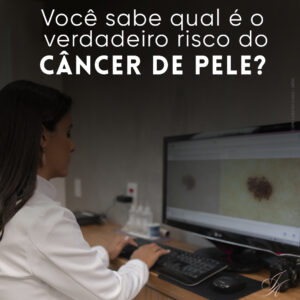 Leia mais sobre o artigo Você sabe qual é o verdadeiro risco do câncer de pele?