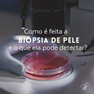 Leia mais sobre o artigo Como é feita a biópsia de pele e o que ela pode detectar?