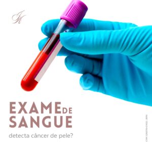 Leia mais sobre o artigo Exame de sangue detecta câncer de pele?