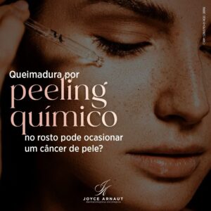 Leia mais sobre o artigo Queimadura por peeling químico no rosto pode ocasionar um câncer de pele?