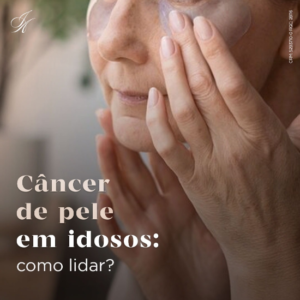 Leia mais sobre o artigo Câncer de pele em idosos: como lidar?