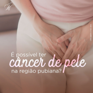 Leia mais sobre o artigo É possível ter câncer de pele na região pubiana?