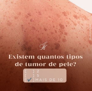 Leia mais sobre o artigo Existem quantos tipos de tumor de pele?