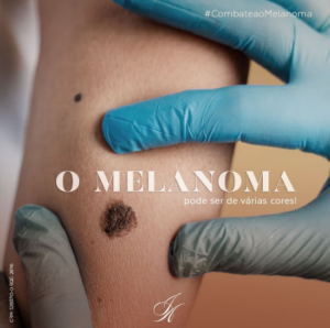 Leia mais sobre o artigo O melanoma pode ser de várias cores!